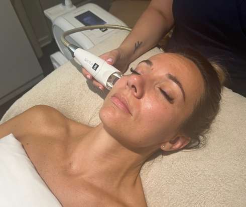 Image de la prestation ENDERMOLIFT VISAGE 20 MINUTES